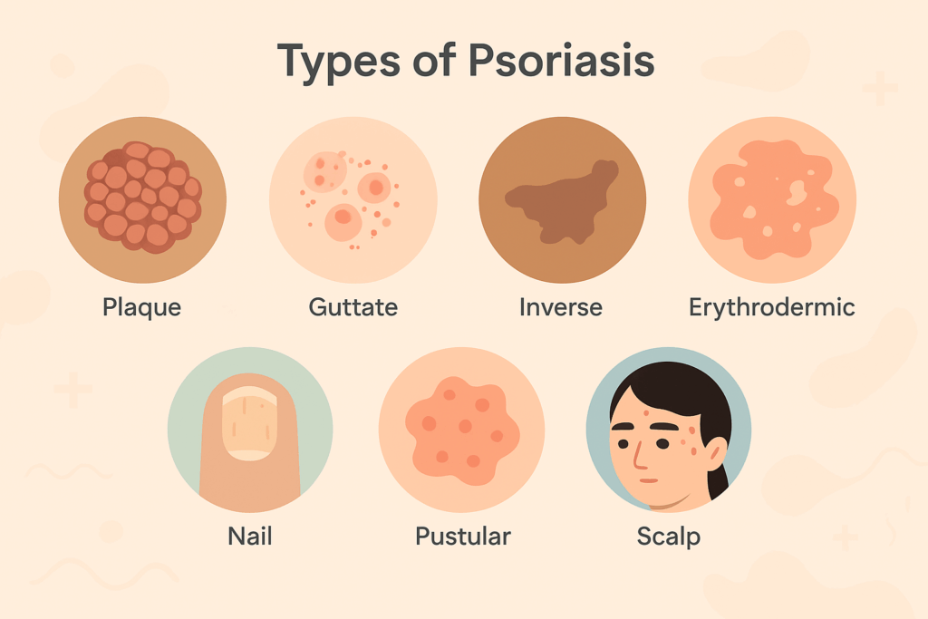 different types of psoriasis